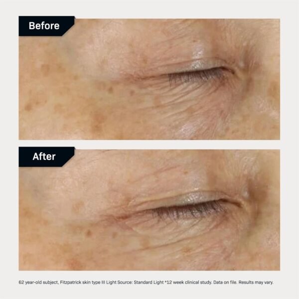 Revision Skincare D·E·J Eye Cream®, Firming and Moisturizing Treatment for Fine Lines, Wrinkles and Crow’s Feet - Image 7