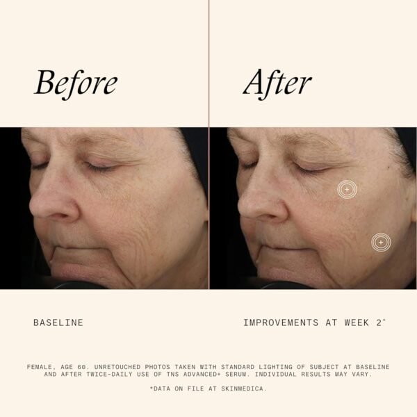 SkinMedica TNS Advanced+ Serum - Our Premium Facial Skin Care Product, the Secret to Flawless Skin. Age-Defying Face Serum for Women is Proven to Address Wrinkles and Fine Lines for Glowing Skin,1 Oz - Image 4