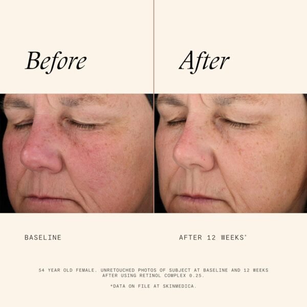 SkinMedica Retinol 0.5 Complex - Retinol Serum for Face, Age-Defying Advanced Retinol Cream That Renews Skin and Diminishes the Appearance of Fine Lines and Wrinkles, 1 Fl Oz - Image 6