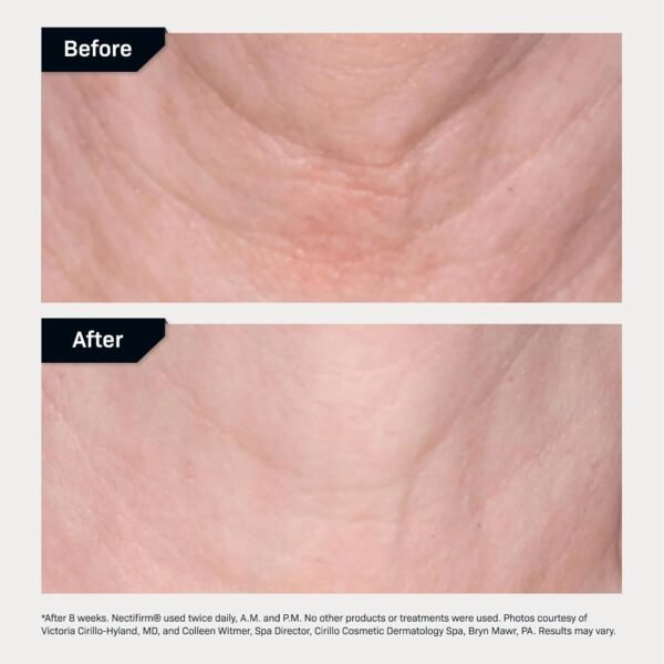 Revision Skincare Nectifirm®, Anti Aging Neck Firming Cream for Reducing Fine Lines, Wrinkles and Crepey Skin - Image 7