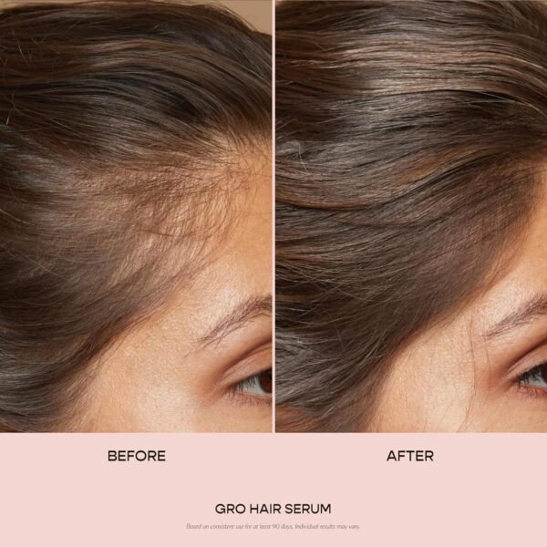 VEGAMOUR GRO Hair Serum for Hair Thinning & Shedding, Thicker Fuller Looking Hair In As Soon As 90 Days, Non Oily, Bergamot Scent, Vegan & Cruelty Free - Image 3
