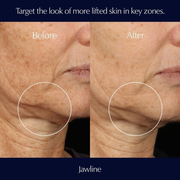 Estée Lauder Perfectionist Pro Rapid Firm + Lift Face Serum with Hexapeptides 8 + 9 - Image 4