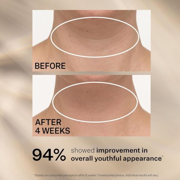 StriVectin Tighten & Lift Advanced Neck Cream PLUS with Alpha-3 Peptides for Neck & Décolleté, Smoothing Look of Wrinkles & Fine Lines, Improves Crepey Skin & Vertical Lines, for Soft Smooth Skin - Image 8