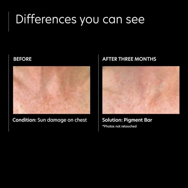 PCA SKIN Pigment Bar, Hyperpigmentation Soap for Dark Spots, Formulated with Azelaic Acid and Kojic Acid, 3.2 fl oz Jar - Image 5