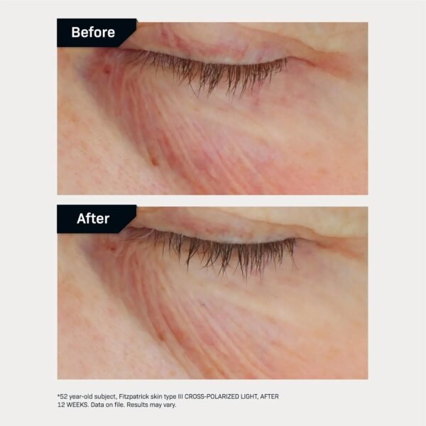 Revision Skincare C+ Brightening Eye Complex™ with Vitamin C and Antioxidants, Eye Cream for Dark Circles and Under Eye Puffiness - Image 8