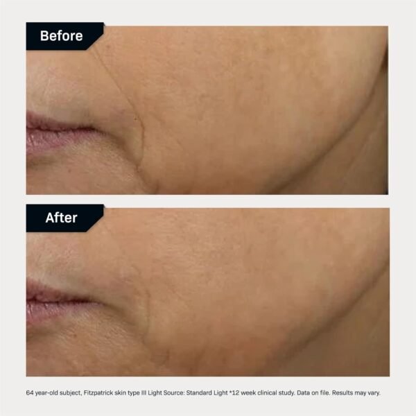 Revision Skincare D·E·J Face Cream®, Advanced Anti Aging Moisturizer, Lifting and Firming, Antioxidant Rich - Image 7