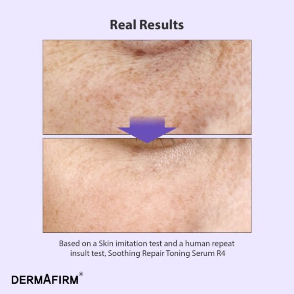 DERMAFIRM Korean Bakuchiol Retinol Serum for Wrinkles w/Niacinamide & Peptides | Soothing Repair Toning Serum R4 for Wrinkle | No Animal Trials 1.01 fl oz - Image 3