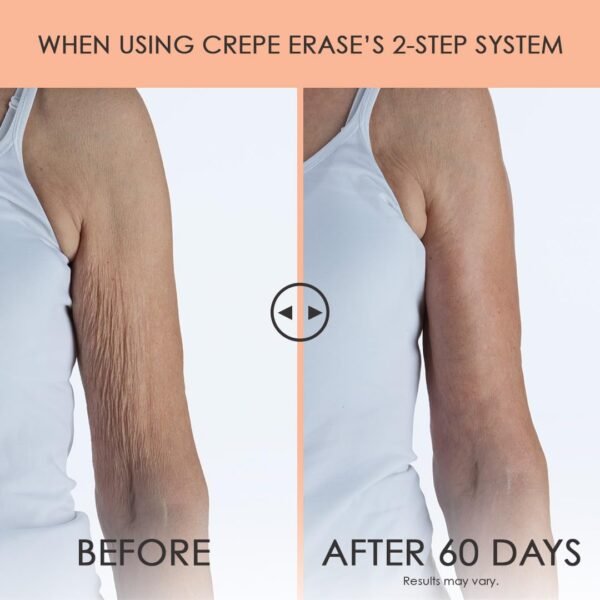 BODY FIRM Crepe Erase Advanced Body Repair Treatment, Anti-Aging Wrinkle Cream, Support Skins Natural Elastin & Collagen Production - 10oz - Image 4