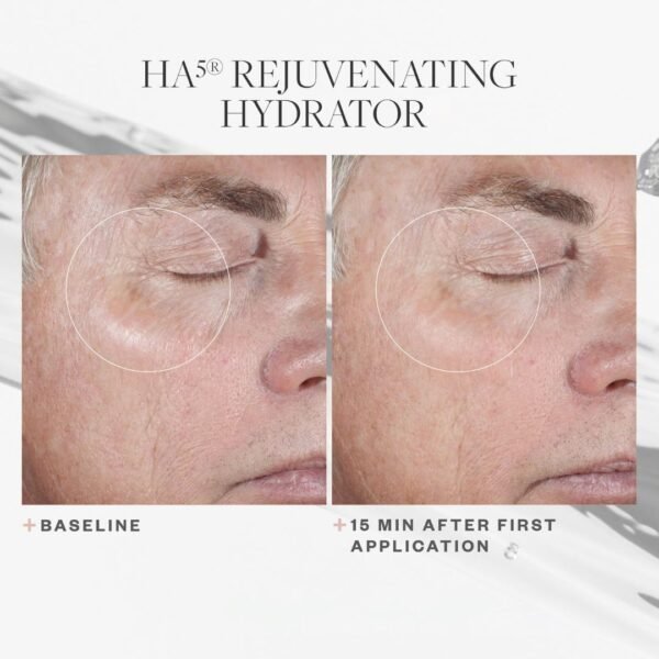 SkinMedica HA5 Rejuvenating Hydrator Hyaluronic Acid Serum for Face with Five Types of Hyaluronic Acid that Smooth Fine Lines and Wrinkles, For All Skin Types, 2 Oz - Image 7