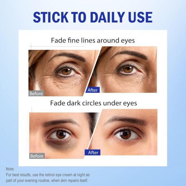 Retinol Eye Cream, Hydrating Under Eye Care Daily Wrinkle Cream, Infused with AHA30% to Smooth and Hydrate Skin, Eye Crea for Dark Circles Treatments, Reduce Under Eye Bags, Smooth Wrinkles, 1Pack - Image 5