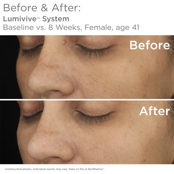 SkinMedica Lumivive Day & Night System - Your Essential Serum Based, Age-Defying Skin Care Set for a Radiant Beauty Routine - Image 6