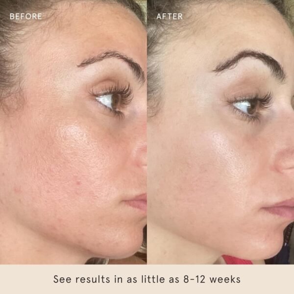 Barefaced Liquid Gold 30ml - 15% Vitamin C Serum with Hyaluronic Acid & Vitamin E for Anti-Aging, and Hydration, Antioxidant Formula, Reduces Dark Spots, Acne & Wrinkles - Image 6