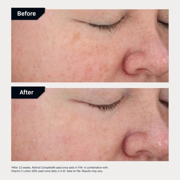 Revision Skincare Retinol Complete® 0.5 Anti Aging Serum, Reduces Fine Lines and Wrinkles, Hydrating and Smoothing - Image 7