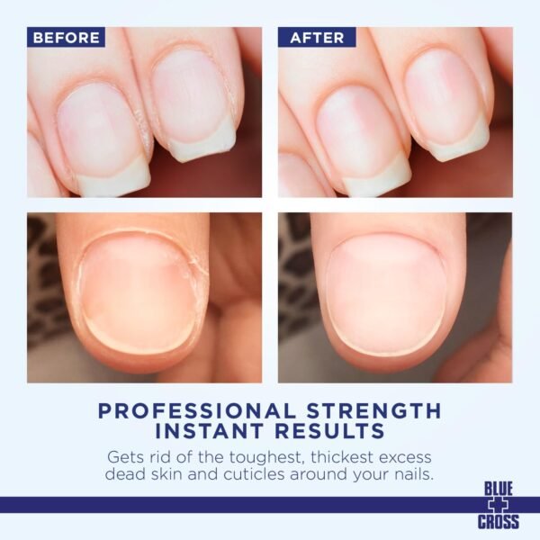 Blue Cross Cuticle Remover Liquid, Cuticle Softener for Nails, Professional Nail Care with Lanolin for Brittle Hang Nails, Hydrating, Moisturizing, Dry Cuticles, Made in USA, 6oz - Image 3