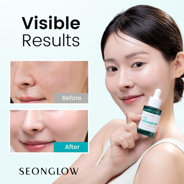 15% Vegan Niacinamide+ 3% Tranexamic Acid Serum: Korean Skin Care Niacinamide serum - Pore Minimizer for Face, Glutathione, Zinc PCA, 1.01 fl.oz.(30ml) - Image 3