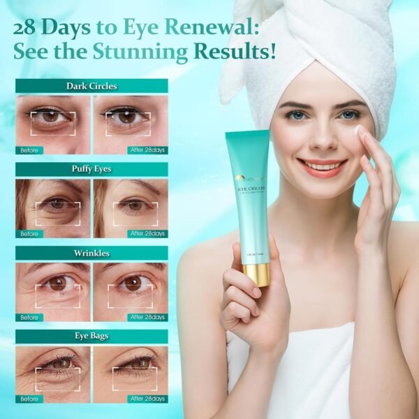 Advanced Eye Cream for Dark Circles - Targeted Solution for Wrinkles, Puffiness, and Firmness - Proven Efficacy with Cynanchum Atratum, and Natural Infusions (30ml) - Image 5