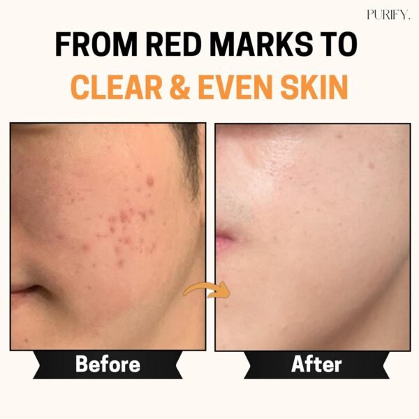 Purify 20% Vitamin C Serum - with Vitamin E & Ferulic Acid - Anti Aging - Brightening Face Serum - Pure Vit C for Dark Spots Correcting, Uneven Skin Tone, Wrinkles, Glow - 1 fl oz. - Image 3