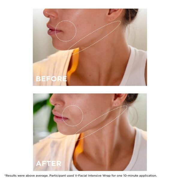 Clarins V-Facial Intensive Wrap Face Mask | Award-Winning Facial Contouring Mask | Visibly Reduces Puffiness and Swelling Caused by Stress,Heat and Hormonal Changes | Promotes Even Skin Tone | 2.5 Oz - Image 5