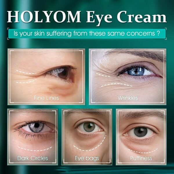Advanced Eye Cream for Dark Circles - Targeted Solution for Wrinkles, Puffiness, and Firmness - Proven Efficacy with Cynanchum Atratum, and Natural Infusions (30ml) - Image 3