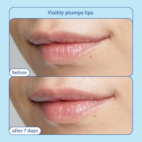 Skinfix Barrier+ Triple Lipid Lip Treatment: Nourish Dry, Chapped Lips With Our Volumizing Complex to Visibly Plump & Fill Fine Lines, 0.27 Oz - Image 5