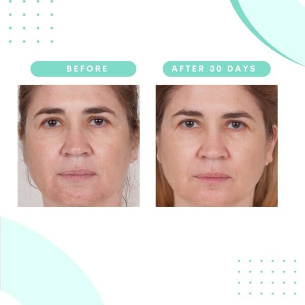 Serious Skincare Glycolic Facial Cleanser 12 oz. + Oscillating Facial Brush Cleansing Tool - Creamy Deep Pore Cleansing Formula - Glycolic Acid - Gentle - Oil Free Face Wash - Image 6