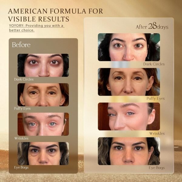 Retinol Under Eye Cream - Anti-aging Eye Cream for Eye Bags, Dark Circles, and Fade Wrinkles, Fine Lines Skin Care Treatment for Women and Men, Gold(0.67 Fl Oz) - Image 6