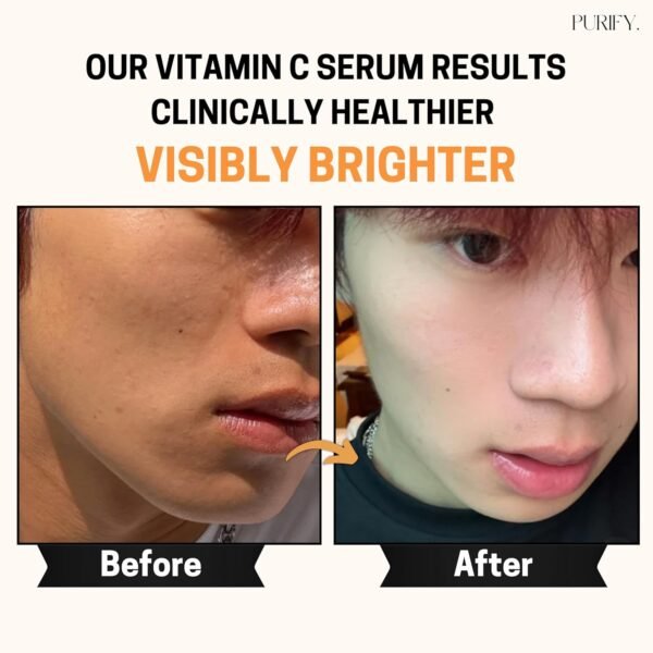 Purify 20% Vitamin C Serum - with Vitamin E & Ferulic Acid - Anti Aging - Brightening Face Serum - Pure Vit C for Dark Spots Correcting, Uneven Skin Tone, Wrinkles, Glow - 1 fl oz. - Image 6
