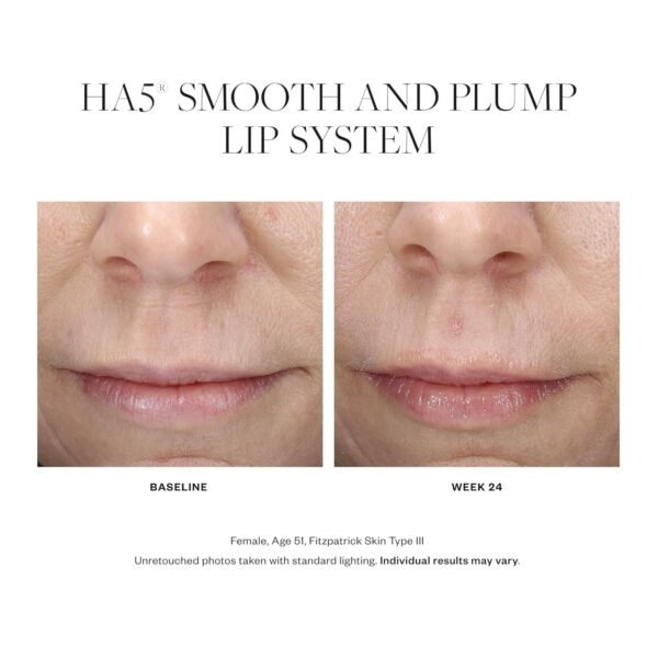 SkinMedica HA5 Smooth & Plump Lip System - Your Hydrating, Volumizing Lip Plumper for Visibly Fuller and Smoother Lips, 0.05 Oz - Image 4