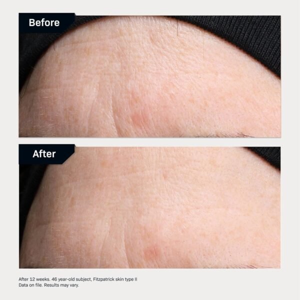 Revision Skincare Revox™ Line Relaxer, Targeted Under Eye Serum with Hyaluronic Acid, Improves Fine Lines and Wrinkles - Image 7