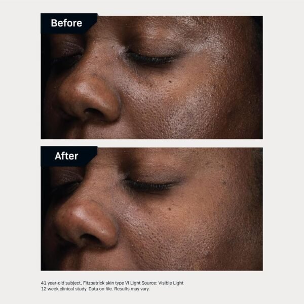 Revision Skincare D·E·J Daily Boosting Serum™, Anti Aging Serum, Reduces Wrinkles, Supports Skin Firmness and Skin Elasticity - Image 6