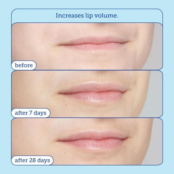 Skinfix Barrier+ Triple Lipid Lip Treatment: Nourish Dry, Chapped Lips With Our Volumizing Complex to Visibly Plump & Fill Fine Lines, 0.27 Oz - Image 6