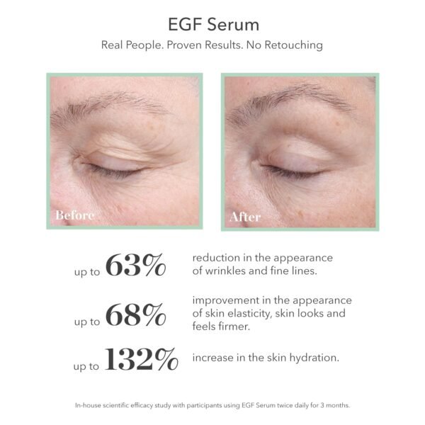 BIOEFFECT EGF Serum Treatment Duo with Hyaluronic Acid, Enhance Skin with Moisturizing, Firming, Wrinkle-Fighting Treatment for Face And Neck, Day And Night, Best Derma Roller Facial Serum - Image 4