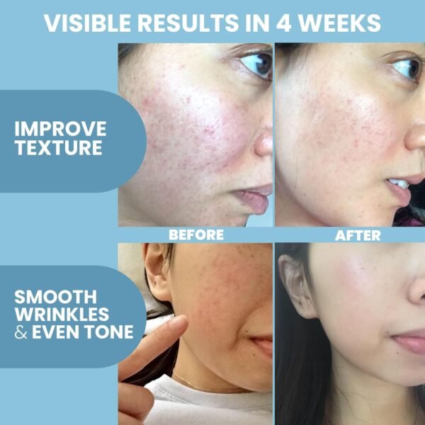 Collagen Peptide - Anti Aging Collagen Serum for Face, Skin Brightening, Reduces Fine Lines & Wrinkles, Heals and Repairs Skin, Microneedling with Hyaluronic Acid (2 oz) - Image 5