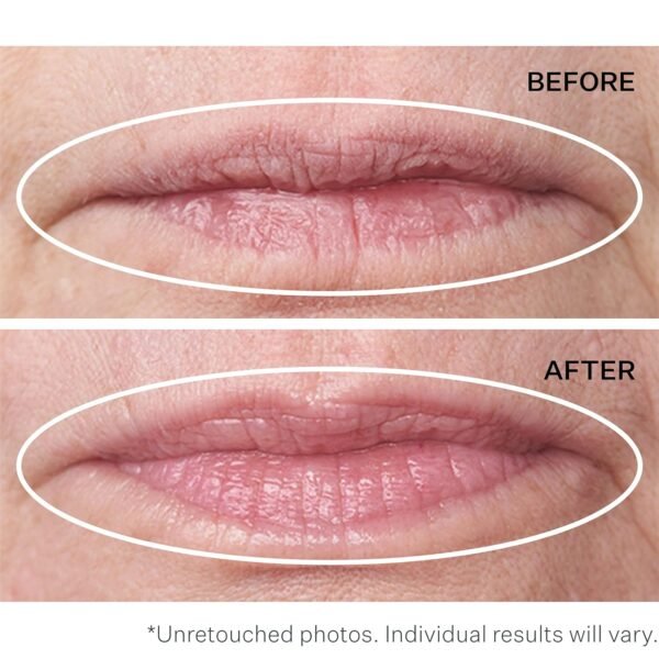 StriVectin Anti-Wrinkle Double Fix for Lips Plump and Smooth Vertical Lines, Hydrating Two-in-One Treatment, 0.16 Fl O - Image 6