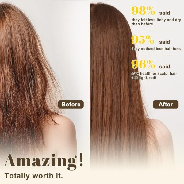 Rosemary Hair Growth Shampoo, Strengthening Shampoo 473 ml(16 fl.oz), For All Hair Types, with Herbal Essential Oils and Plant Extracts for Thinning Hair for Women and Men - Image 10