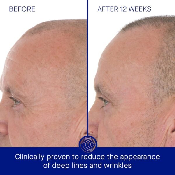 The Retinol Serum - Image 5