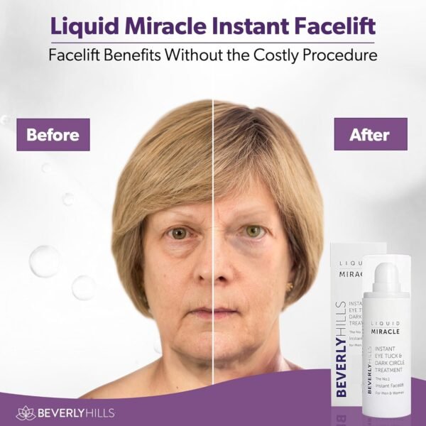 Beverly Hills Instant Facelift Anti Aging Eye Serum Treatment for Dark Circles, Puffy Eyes, Wrinkles, Under Eye Bags, Fine Lines, and Crows Feet | 30mL (120 Days Supply) - Image 5