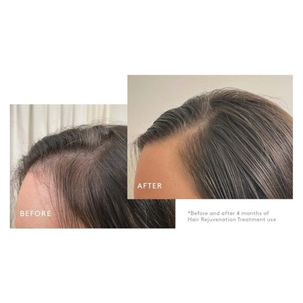Virtue Flourish Shampoo, Conditioner and Density Booster Treatment Bundle for Thinning Hair for Women, 100% Drug-Free Regimen - Image 6
