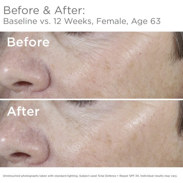 SkinMedica Total Defense + Repair SPF 34 Sunscreen for Face. This Lightweight, Facial Sunscreen is Ideal for Oily and/or Combination Skin, 2.3 Oz - Image 4