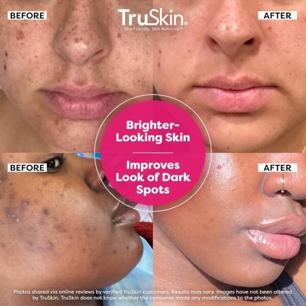 TruSkin Vitamin C Super Serum - Niacinamide, Retinol, Hyaluronic & Salicylic Acid - All-in-One Anti Aging Serum for Face – Improve Appearance of Dark Spots, Firmness for Brighter Looking Skin, 1 Fl Oz - Image 3