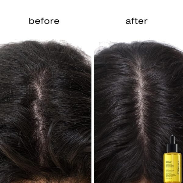 Essence Absolue Pre-Shampoo & Nourishing Treatment Oil - Soothes Dry and Flaky Scalp, Leaves Scalp Moisturized and Balanced, Nourishes For Soft and Shiny Hair, 1.7 Fl Oz - Image 3