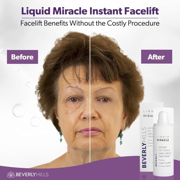 Beverly Hills Instant Facelift Anti Aging Eye Serum Treatment for Dark Circles, Puffy Eyes, Wrinkles, Under Eye Bags, Fine Lines, and Crows Feet | 30mL (120 Days Supply) - Image 4