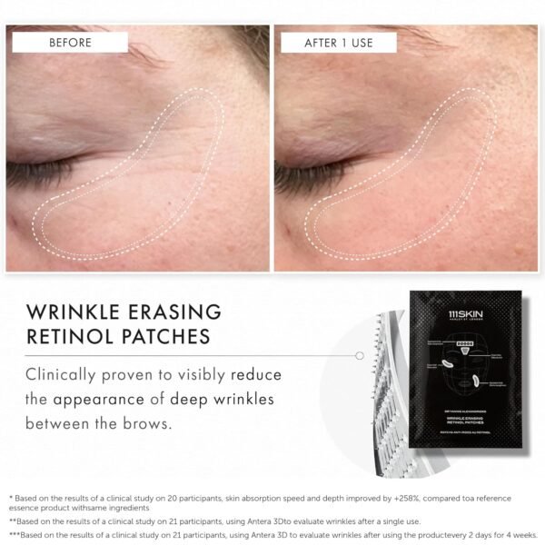 111SKIN Wrinkle Erasing Retinol Patches, Non-Invasive Forehead Wrinkle Patches for Under Eye & Smile Line Set with Vitamin C, Peptides & Microcone Technology, Suitable for All Skin Types, 3 x 1.23 oz - Image 9