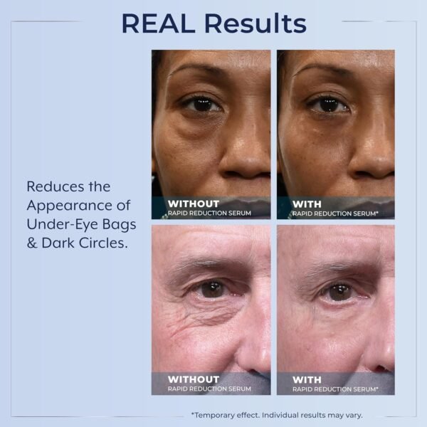 Plexaderm Rapid Reduction Eye Serum - Visibly Reduces Under-Eye Bags, Wrinkles, Dark Circles, Fine Lines & Crow's Feet Instantly, Anti Aging Wrinkle Remover for Face, Pump - Image 7
