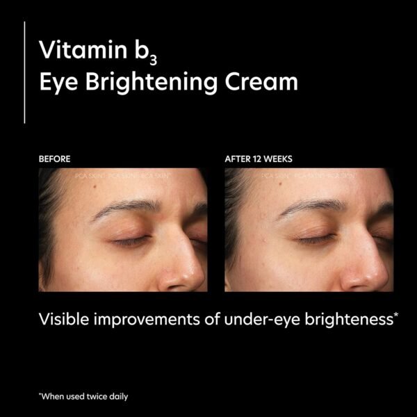 PCA SKIN Vitamin B3 Eye Brightening Cream, Eye Brightener For Bright Eyes, Dark Circles, Wrinkles, and Uneven Skin Tones, Anti Aging Eye Cream, Formulated with Niacinamide, 1 oz Tube - Image 6