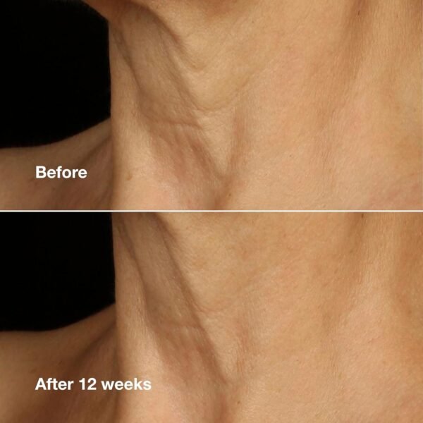 Clinique Smart Clinical Repair Lifting Face + Neck Cream with Peptides + Hyaluronic Acid | Anti-Aging + Hydrating - Image 5