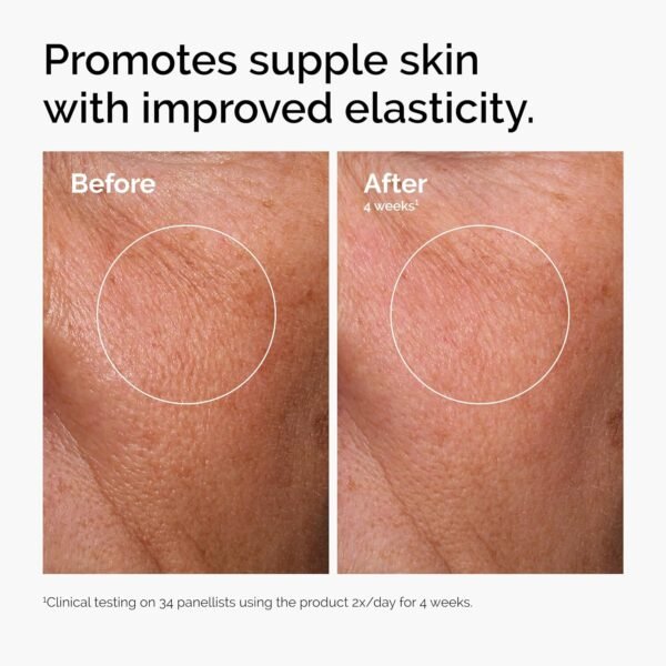 The Ordinary Hyaluronic Acid 2% + B5 (with Ceramides), Multi-Depth Hydration Serum for Plumper, Smoother Skin - Image 3