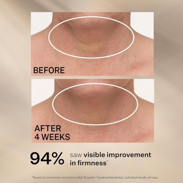 StriVectin Tighten & Lift Advanced Neck Cream PLUS with Alpha-3 Peptides for Neck & Décolleté, Smoothing Look of Wrinkles & Fine Lines, Improves Crepey Skin & Vertical Lines, for Soft Smooth Skin - Image 7