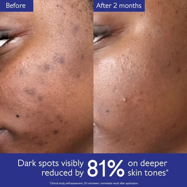 Caudalie Vinoperfect Brightening Dark Spot Serum Vitamin C Alternative - 62x More Effective than Vitamin C with Viniferine for a Visibly Brighter Even Complexion - Image 6