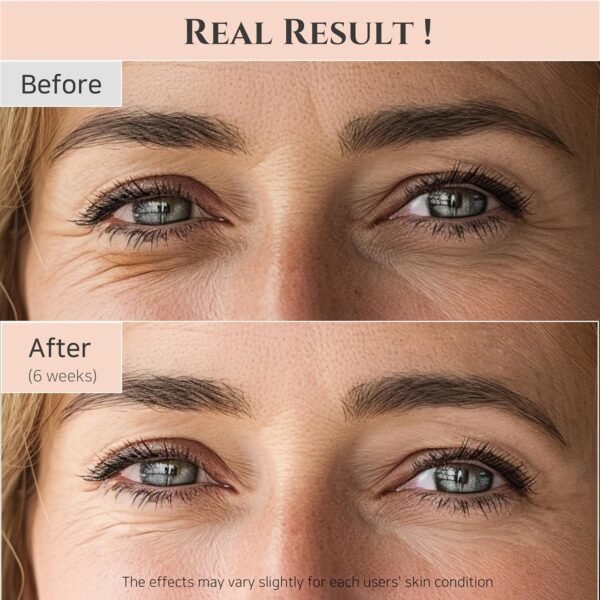 Beauty of Joseon Revive Eye Serum with Retinal Niacinamide Correction for Puffy Eye Bags Fine Lines Dark Circles Wrinkles, Korean Skin Care 30ml, 1 fl.oz - Image 4